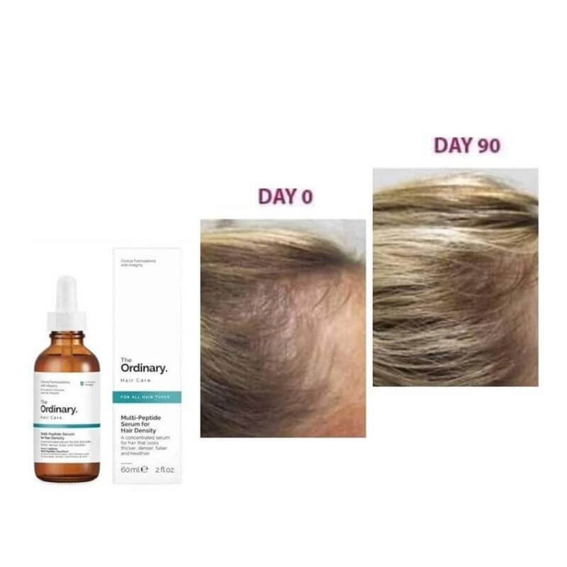 The Ordinary Multi-Peptide Hair Serum for Hair Density 30ml - Image 3
